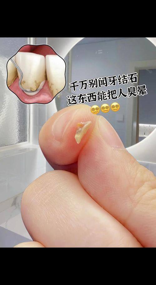 泰安泰安市雅可喜口腔价格表: