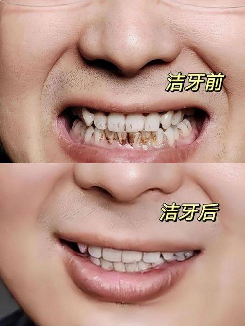 泰安泰安市雅可喜口腔口碑评价: