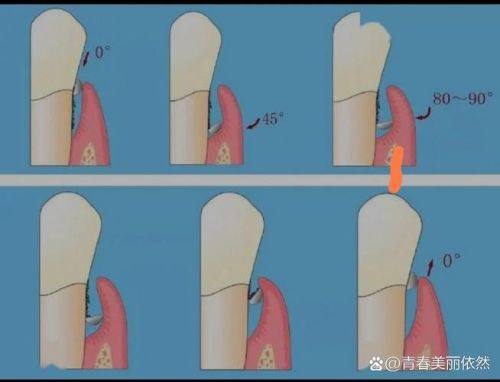 崔庆岩医生技术优势：