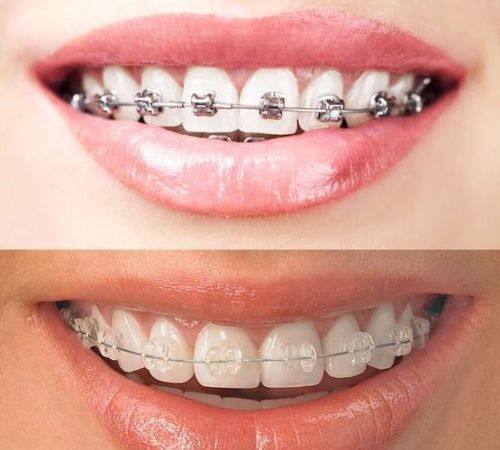 北京海德堡联合口腔医院擅长项目