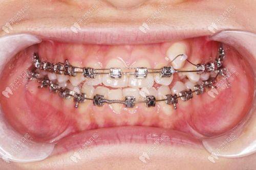 武汉好呀医口腔预约挂号方式