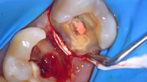 宁夏中卫中宁精艺口腔怎么样?