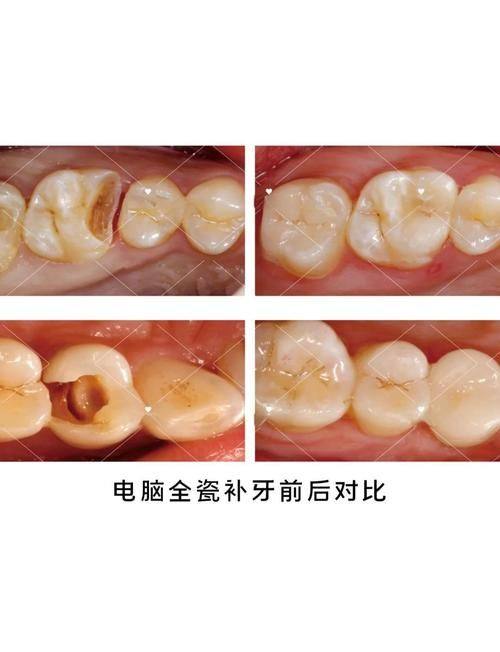北京海德堡联合口腔医院怎么样?