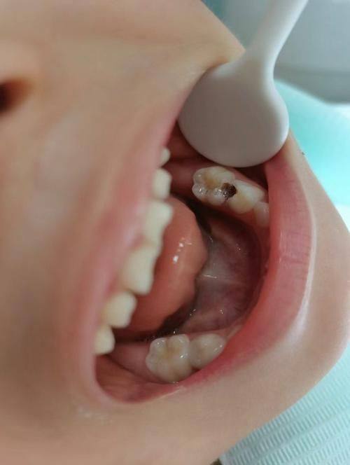 崔庆岩医生怎么预约？