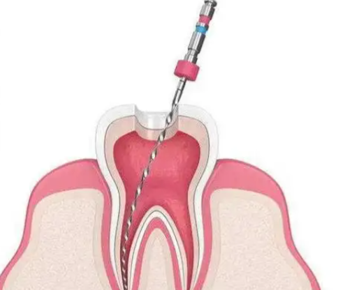 三、不同洗牙方式对应的时长差异