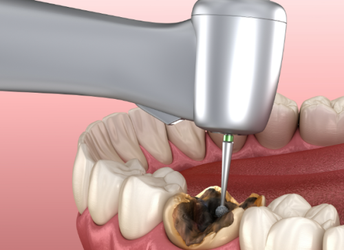 山东德州夏津董传兴口腔预约挂号方式：