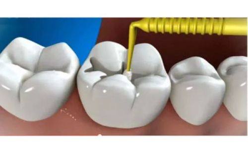 浙江金华永康阳光口腔价格表: