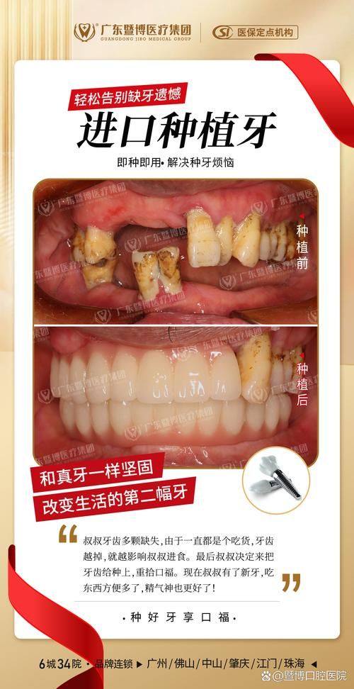 昆明美伊莱口腔门诊医生名单及擅长领域: