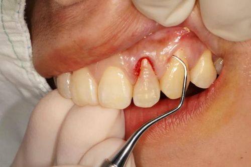 江苏镇江扬中牙洁美口腔诊所地址电话及营业时间：