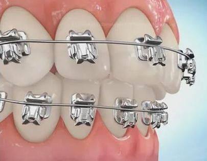 江苏苏州诺一口腔诊所（狮山龙湖店）预约挂号方式