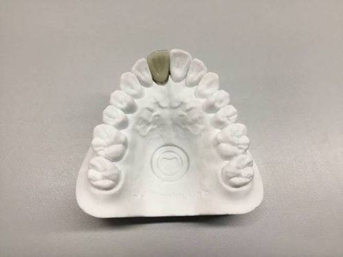 昆明美伊莱口腔门诊预约挂号方式