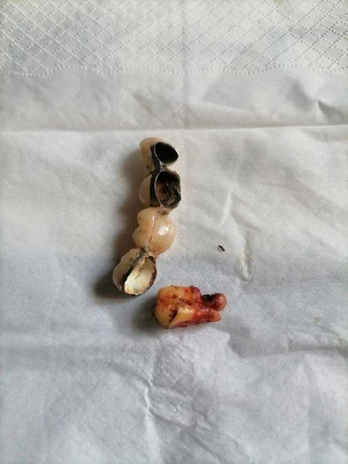 昆明美伊莱口腔门诊怎么样?