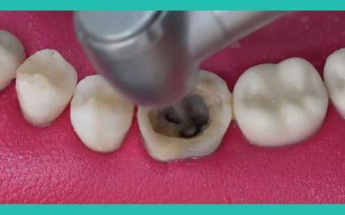 昆山瑞齿口腔门诊部价格表: