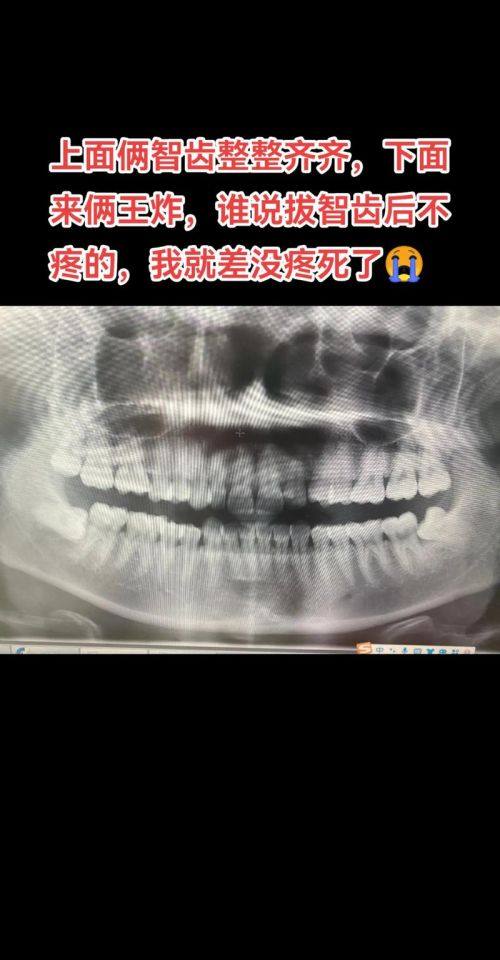 牛纪霞医生技术优势