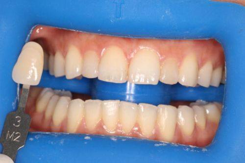 浙江金华永康阳光口腔预约挂号方式: