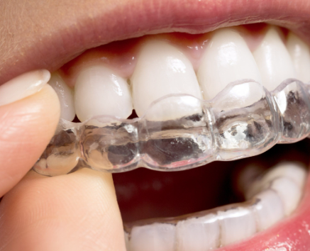 五、牙周炎疼痛洗牙后的护养要点