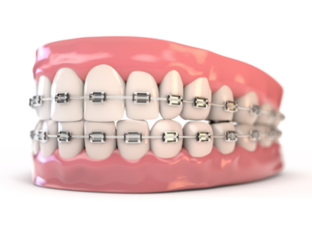三、牙周炎疼痛时,洗牙配合用药更稳妥