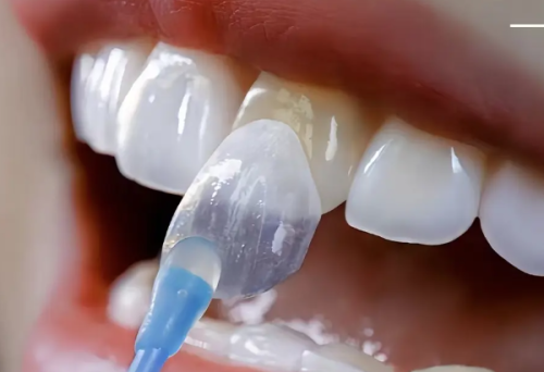 五、为什么根管治疗常被俗称“杀神经”“抽神经”