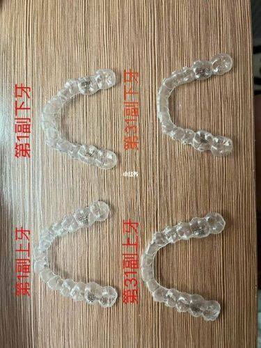 河南南阳方城万超口腔正畸种植项目全解析，看牙不用愁