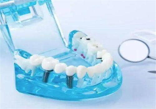 东莞仁康医院口腔科