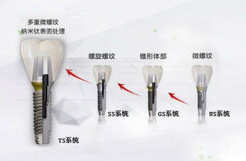 五、科学洗牙的正确打开方式