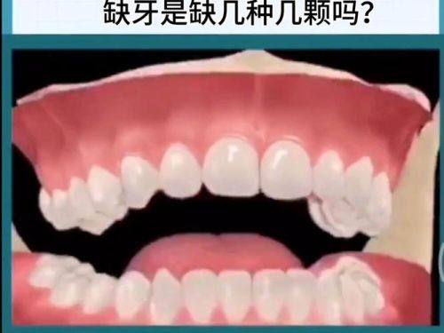 金帮明医生技术优势：