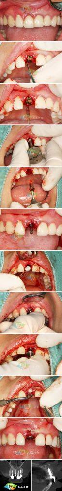 东莞仁康医院口腔科怎么样？