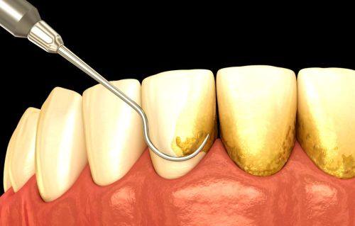 遵义名仕口腔擅长项目
