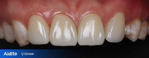 舟山益齿口腔预约挂号方式