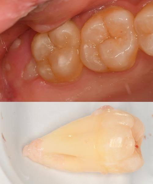 崔庆岩医生技术优势：
