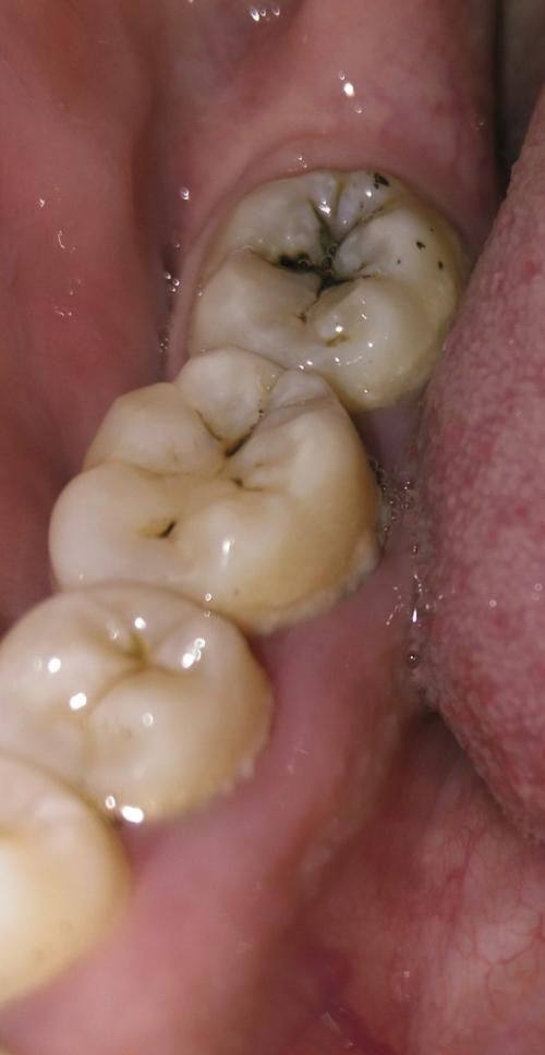 孝感健吉口腔门诊部擅长项目：