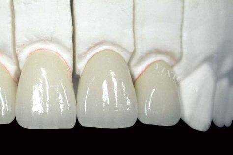 东莞仁康医院口腔科口碑评价：