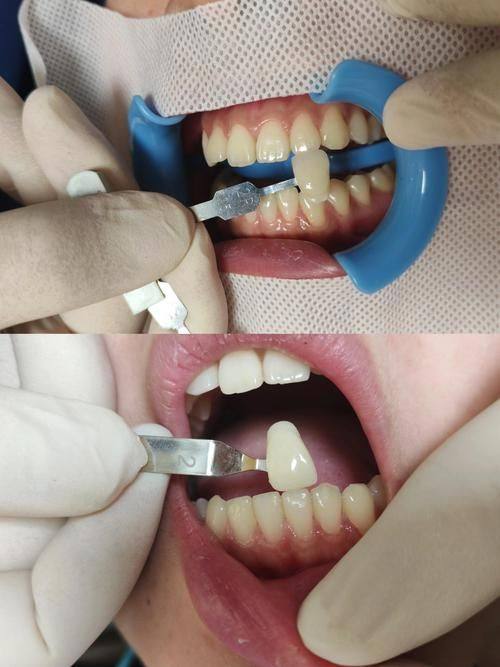 舟山益齿口腔医生名单及擅长领域：