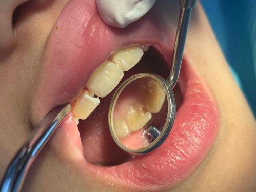 舟山益齿口腔擅长项目