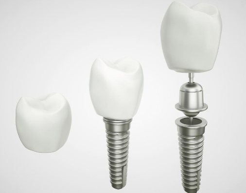 三、拔牙三天可以吃一点点辣椒吗