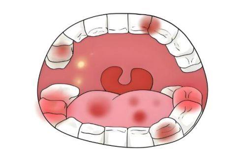 二、不同假牙类型的具体安装时机