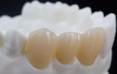 四、术中关键注意事项：规避应激与出血风险