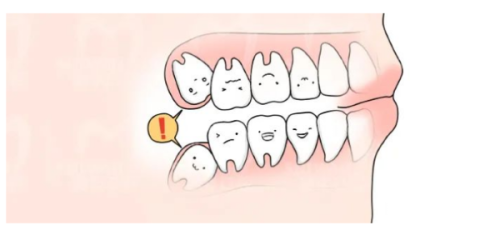四、个性化调整的参考要点