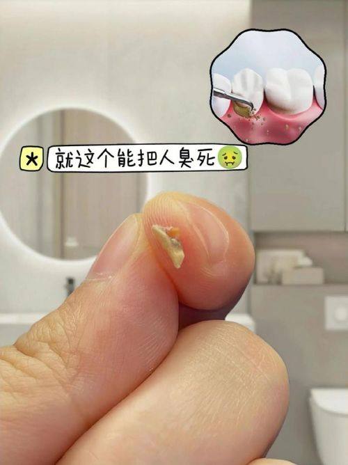 广东东莞虎门皓齿健口腔门诊部预约挂号方式