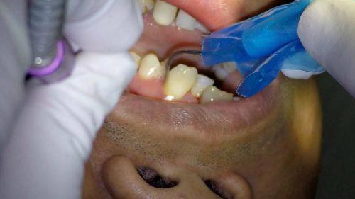 东莞石排威佰洲口腔门诊部口碑评价：