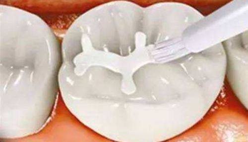 湖南省永州市零陵区妇幼保健院口腔科擅长项目：