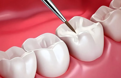 扬州笑然口腔门诊部擅长项目：