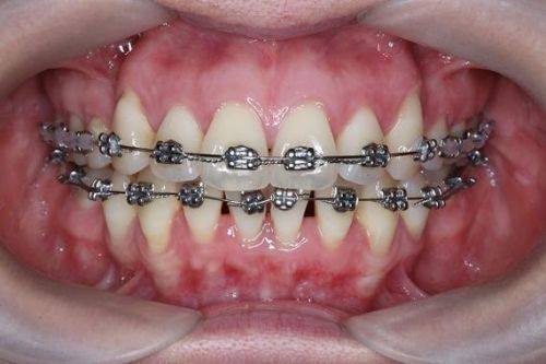 马金盼医生擅长领域