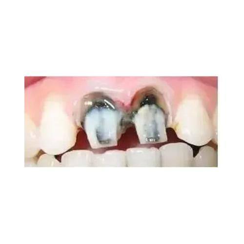 淄博博山纪强口腔预约挂号方式：