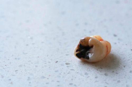 淄博张店瑞洁口腔诊所预约挂号方式：