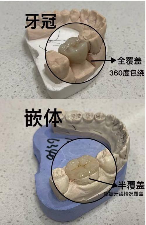 吴世莲医生技术优势