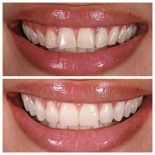 吴世莲医生怎么预约