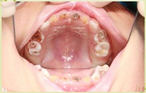 淄博博山纪强口腔擅长项目：