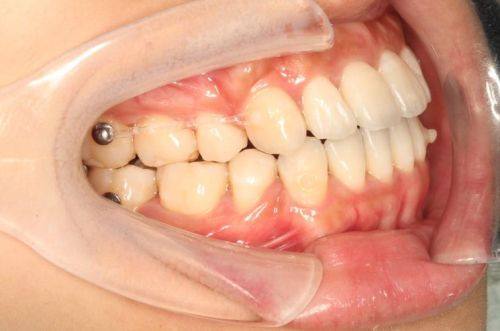 陆逊医生怎么预约