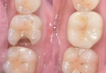 扬州笑然口腔门诊部预约挂号方式：